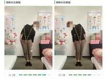 スマイル整体院/AI画像診断