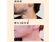 リノ(Lino)の雰囲気（髭脱毛初めての方も通いやすさ◎丁寧な施術で効果◎土日予約◎）