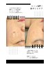 6月【シミ】【月~金】夏、気になって来たシミ集中ケア(シミ5個)→初回¥3,800