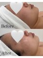 リル(relle)&nbsp;ネイルだけでなく手肌・お肌のお悩みもご相談ください♪