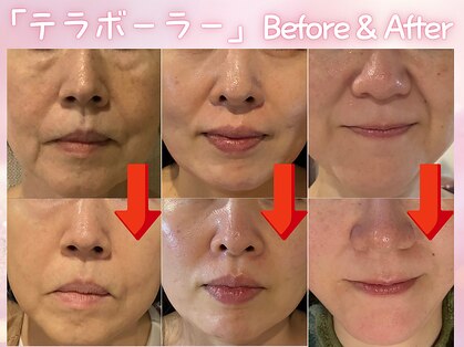 ナイア(naia)の写真