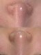 サロンドミュウ(Salon de Mieux)の写真/【ぴかぴか毛穴を目指したい方】本気の肌質改善で開いた毛穴にアプローチ、毛穴レスのお肌を目指せます♪