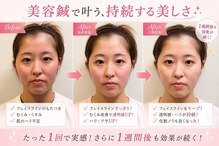 らいおん整骨院 喜多見店