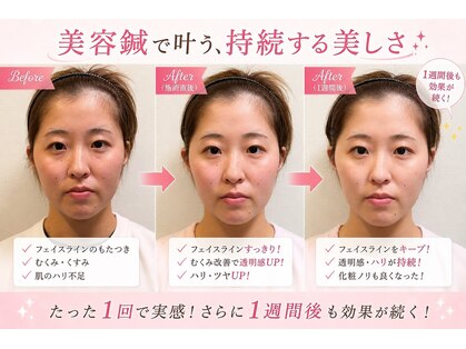 らいおん整骨院 喜多見店の写真