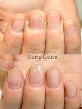 マリーロール 梅田店(Marie Laure)/自爪育成/深爪矯正/ネイルケア