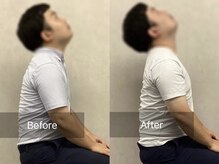 博多おかげ整体院/整体＆姿勢矯正ビフォーアフター