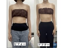 メリアミーゴ(Meli amigo)/30代　肩凝り