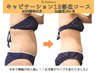 【夏後半に向けて】本気で痩せる！脂肪燃焼キャビテーション3部位×骨盤矯正