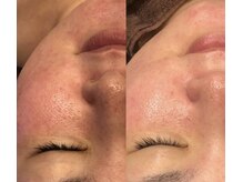 リ クリニカル ラボ(Re clinical Labo)/最速で効果を実感★