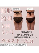 アイビー(IVY)/効果をしっかり感じられた！