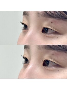 ビョル(byeol)の写真/《四条駅/まつ毛パーマ》専門技術を持つアイリスト在籍◎お悩みに合わせ、丁寧に施術いたします。