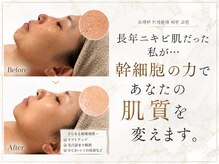 アンフィア(Anfia)の雰囲気（【肌質管理】ハーブピーリング×ヒト幹細胞◇確実ツル肌になれる）
