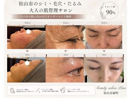 リノ(Lino)の写真