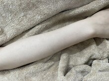 ナノハナ/鹿沼市全身脱毛美容室ナノハナ