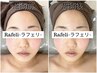 【速攻実感◎たるみ改善！】小顔コルギ＋肩甲骨ほぐし♪60分¥8,800→¥6,980