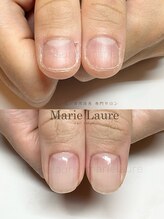 マリーロール 梅田店(Marie Laure)/深爪改善/自爪育成/ネイルケア