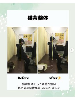 東灘区甲南山手わだち整骨院/猫背矯正ビフォーアフター