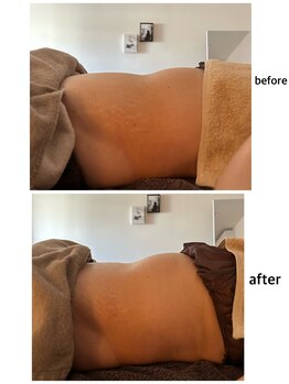 ジョワイユ(Joyeux)/腸の位置でお腹は変わる