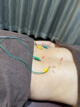 円山よもぎ鍼灸整骨院