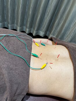 円山よもぎ鍼灸整骨院の写真/【最終受付20時/半個室/Pあり】女性に人気《自律神経に特化した鍼灸院》お灸＆美容鍼など美容メニューも♪