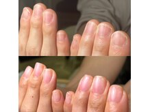 ニューネイル(NEW☆NAIL)の雰囲気（指先を酷使する看護師さんでも綺麗な爪を叶えられる☆）