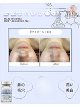 肌イズム 守谷店(肌ism)/【before&after】ダクトピール