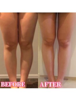 薫風/痩身+ファスティングでの効果