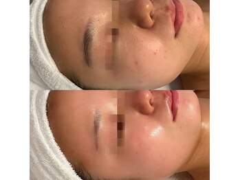 フランジパニ(FRANGIPANI)