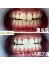 ルブラン 奈良店(Le Blanc)/リーズナブルで短時間の