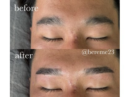 ベリーム(bereme)の写真