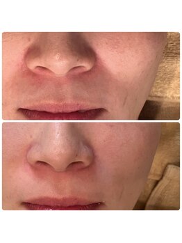 ラキア 五位堂駅前店(Ra kia)/たるみケア