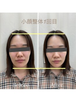 クローバー整体院/小顔整体×ヘッドスパ(施術1回)