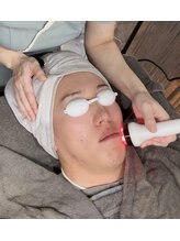 エール(AEELE)/■ハイドラ毛穴洗浄（顔）■