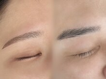 Q5.ワックス脱毛とは何ですか？