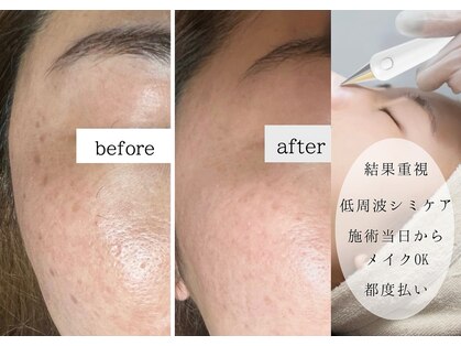 ルクス(LUX)の写真