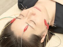 はりきゅう花桃の雰囲気（電気を流すお顔の美容鍼）