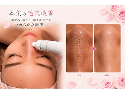 メディカルエステサロン ローズ 鯖江店(ROSE)の写真
