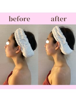 ココ(COCO)/お客様ビフォーアフター