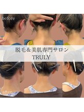 トゥルーリー(TRULY)/冬も大人気のうなじ脱毛