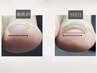 【フット】特殊ジェルで巻き爪ケア+ワンカラー【ケア2本＋ワンカラー10本】