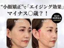 お顔のたるみ・エラ張り・ほうれい線・二重あご・むくみにも対応