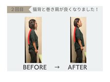 整体院 欅/整体効果　猫背、巻き肩