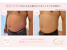 シエル(Ciel)の雰囲気（脂肪冷却は男性のお客様もOKです！）