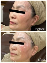 ジャスミン(Jasmin)/エステティック×シェービング