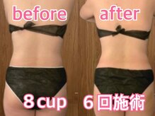 ユー(U)の雰囲気（50代　女性　脂肪冷却（腰肉/脇肉/お腹/浮き輪肉/脂肪をカット））
