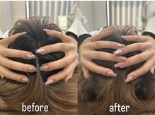 おひさま整骨院 整体院 姫路店/B＆A【姫路/小顔矯正/整体】