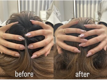 おひさま整骨院 整体院 姫路店/B＆A【姫路/小顔矯正/整体】