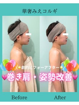 アコガレコガオ 鳥取店/コルギのビフォーアフター