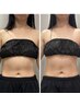 NEW【トリプルお腹集中コース】当店開発こだわりハイパー×キャビ×引き締め