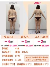 スリムステーション 草津(Slim Station)/腹部の影が薄く！！